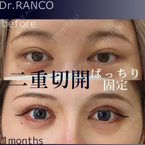 症例