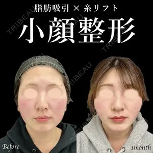 症例