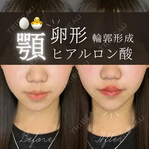 ルラ美容クリニック 大宮院 右京 大季医師の症例