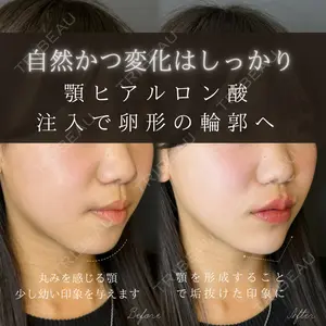 ルラ美容クリニック 大宮院 右京 大季医師の症例