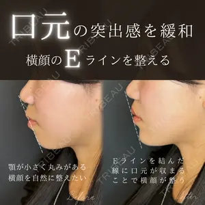 ルラ美容クリニック 大宮院 右京 大季医師の症例