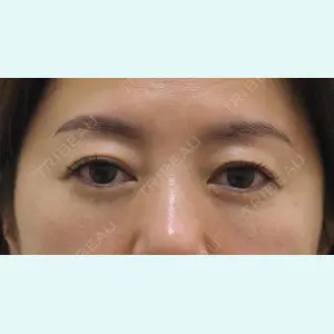 セオリークリニックの症例