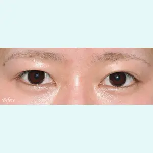 パールスキンクリニック天神 山道光作医師の症例
