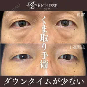 症例