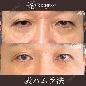 症例