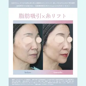 症例