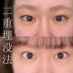 症例