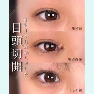 症例