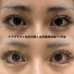 エターナル美容クリニック 久門田 詳医師の症例