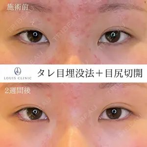 LOUIS CLINIC 二子玉川院【ルイクリニック】 小松 塁医師の症例