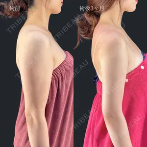 HAAB×DREAM BEAUTY CLINIC 東京本院 吉岡 修一医師の症例