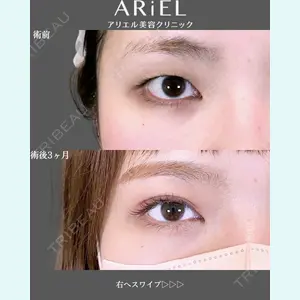 アリエル美容クリニック 郡山院 安齋 誠基医師の症例