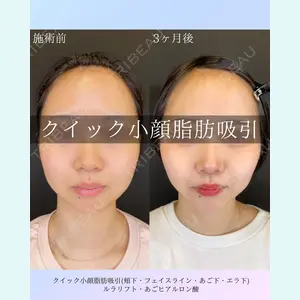 ルラ美容クリニック 札幌院 佐藤 雄紀医師の症例