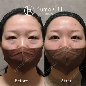 Kuma CLI 【クマクリ】 毛利 理人医師の症例
