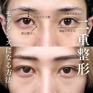 MEMOTO CLINIC 名古屋 鈴木 大路医師の症例