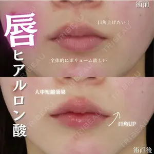 症例