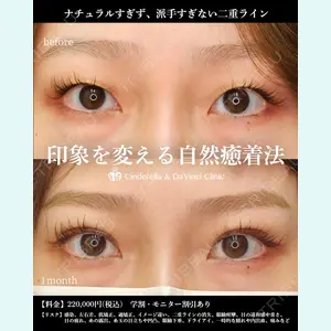 シンデレラ＆ダヴィンチクリニック 宮田 洋佑医師の症例