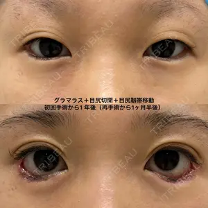 エターナル美容クリニック 久門田 詳医師の症例
