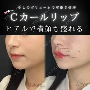 ルラ美容クリニック 大宮院 右京 大季医師の症例