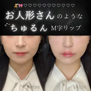 ルラ美容クリニック 大宮院 右京 大季医師の症例
