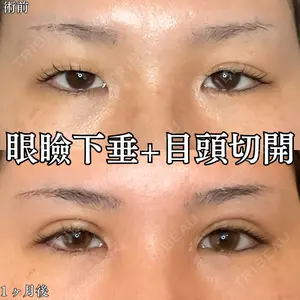 形成外科と美容外科のクリニック池袋 春日 航医師の症例