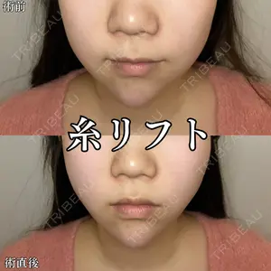 形成外科と美容外科のクリニック池袋 春日 航医師の症例