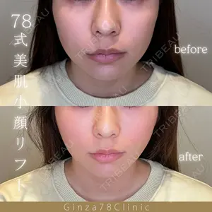 症例