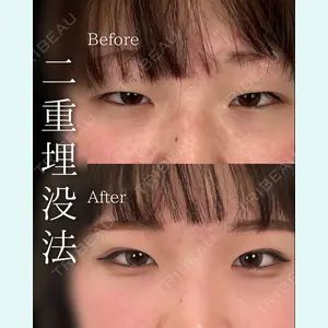 症例