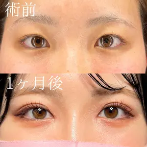 症例
