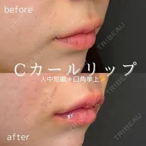 ルラ美容クリニック 仙台院の症例