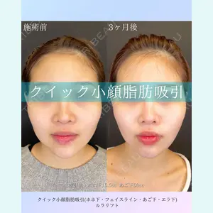 ルラ美容クリニック 札幌院 佐藤 雄紀医師の症例