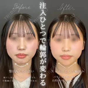 ルラ美容クリニック 大宮院の症例