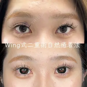 症例