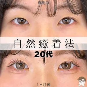 ルラ美容クリニック 札幌院 佐藤 雄紀医師の症例