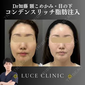ルーチェクリニック 銀座院 加藤晴之輔医師の症例