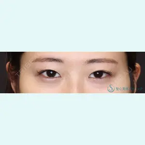 聖心美容クリニック 六本木院 綾部 奈々子医師の症例