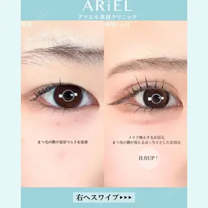 アリエル美容クリニック 大宮院 鈴木　桂介医師の症例