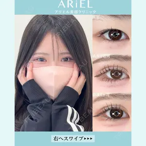 アリエル美容クリニック 大宮院 鈴木　桂介医師の症例