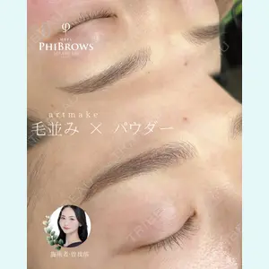 症例