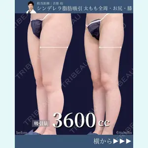 東京シンデレラ美容外科 新宿院 吉原 伯医師の症例