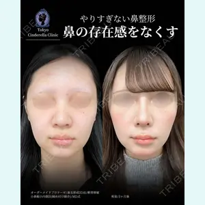 東京シンデレラ美容外科 新宿院 吉原 伯医師の症例