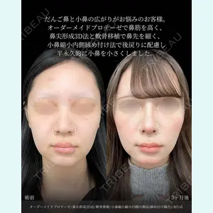 東京シンデレラ美容外科 新宿院 吉原 伯医師の症例