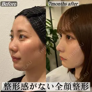症例