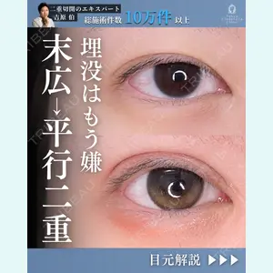 東京シンデレラ美容外科 新宿院 吉原 伯医師の症例