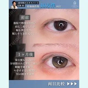 東京シンデレラ美容外科 新宿院 吉原 伯医師の症例