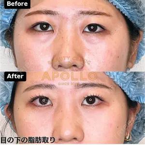 APOLLO BEAUTY CLINICの症例