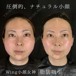 症例