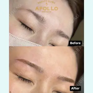 APOLLO BEAUTY CLINIC 鬼沢 正道医師の症例