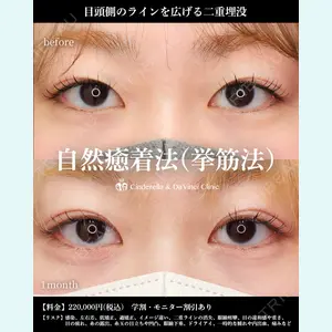 シンデレラ＆ダヴィンチクリニック 宮田 洋佑医師の症例