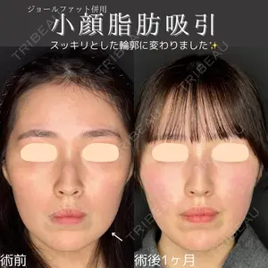 ルラ美容クリニック 仙台院の症例